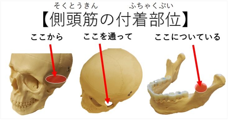 側頭筋の付着部位の説明