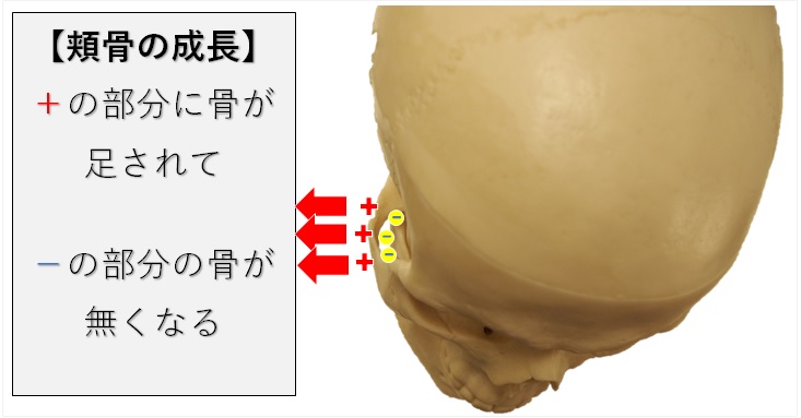 頬骨の骨添加と骨吸収