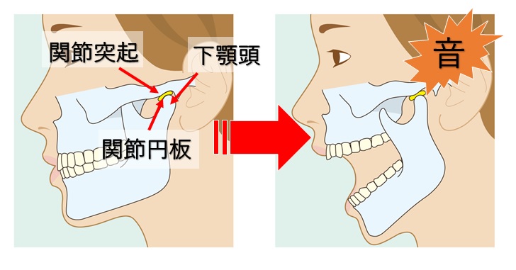 顎関節の構造と各部位の説明