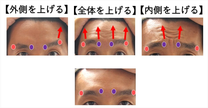 眉骨が出てる顔を自分で治すのは難しいですか お悩み相談 小顔矯正 整体を東京でお探しならrevision