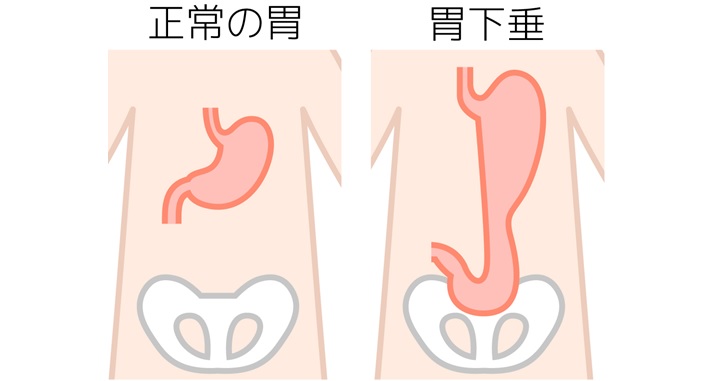 ぽっこりお腹の原因は骨盤前傾 後傾 あなたはどっちタイプ 小顔矯正 整体を東京でお探しならrevision