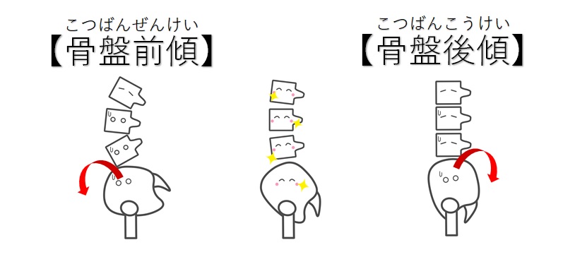 ぽっこりお腹の原因は骨盤前傾 後傾 あなたはどっちタイプ 小顔矯正 整体を東京でお探しならrevision