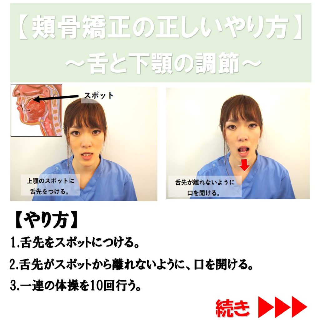 頬骨矯正（舌と下顎の調節）