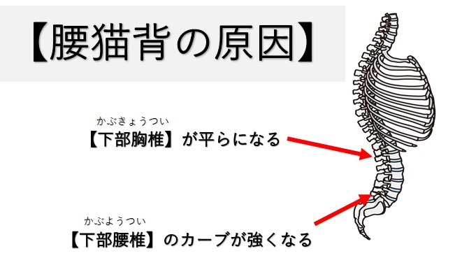 腰が猫背な腰猫背の原因と改善方法を４つまとめてみました 小顔矯正 整体を東京でお探しならrevision