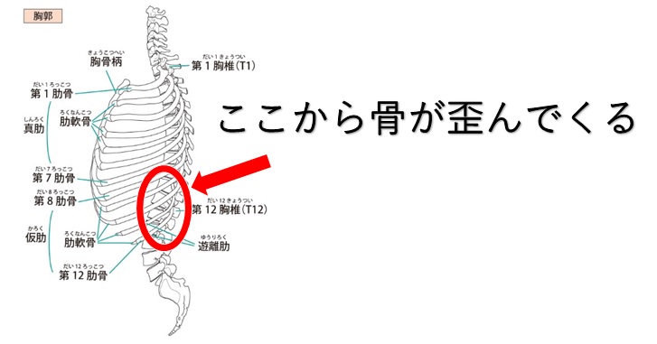 胸腰椎骨移行部の画像