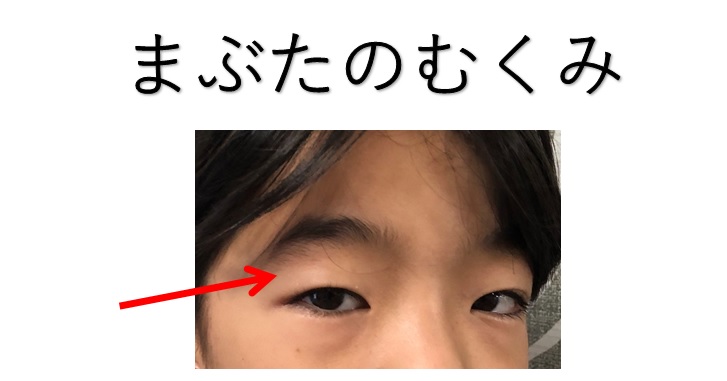 顔が平面だと思ったらチェックすべきポイント３つ 小顔矯正 整体を東京でお探しならrevision