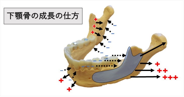 下顎骨の成長（骨添加と吸収）