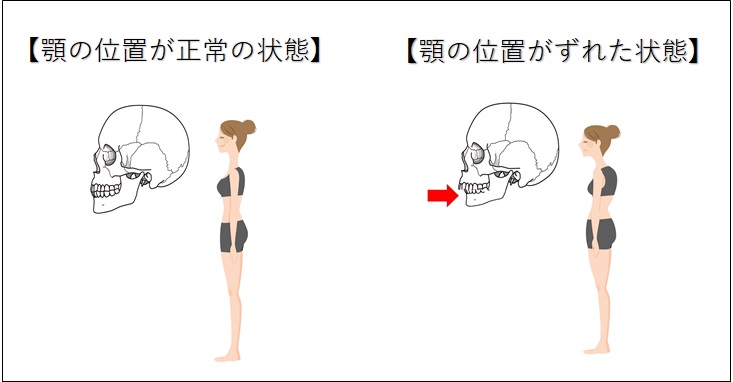 顎の位置と姿勢の関係