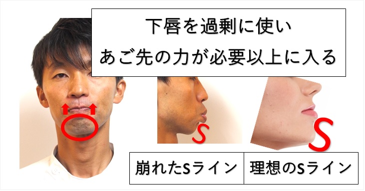 顎がない顔立ち改善メソッド 口筋機能改善体操のやり方３選 小顔矯正 整体を東京でお探しならrevision