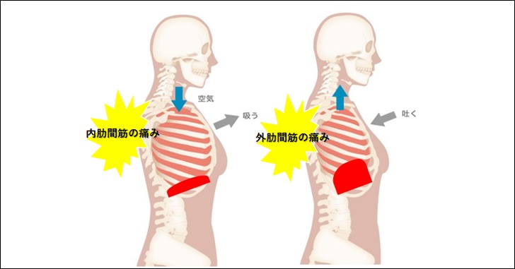 呼吸すると背中が痛い時の対処法を接骨院の先生が教えます 小顔矯正 整体を東京でお探しならrevision