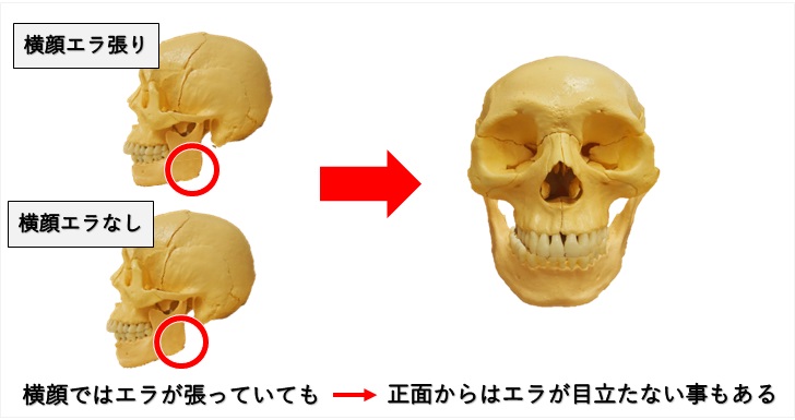 小顔の特徴はここの３つの骨が小さい事にある 原因と対策 小顔矯正 整体を東京でお探しならrevision