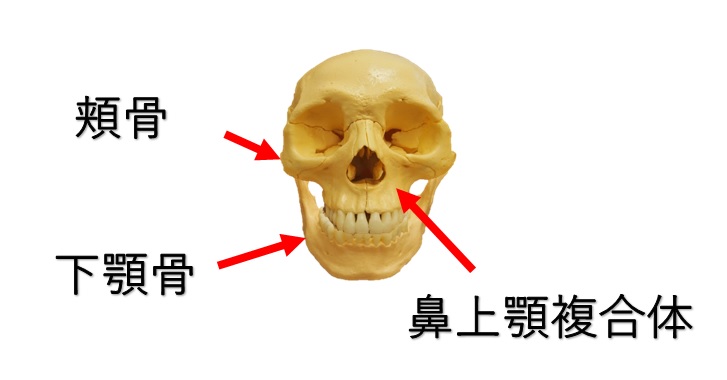 下顎骨と頬骨と鼻上顎複合体の図示