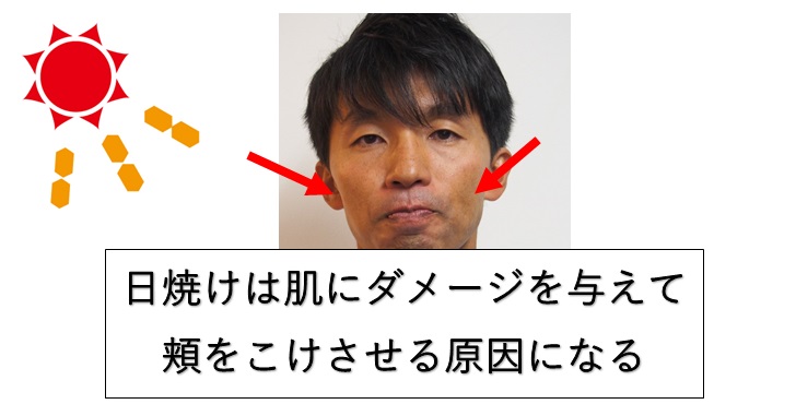 頬をふっくらさせる方法のポイントは肌の活性化 小顔鍼灸編 小顔矯正 整体を東京でお探しならrevision