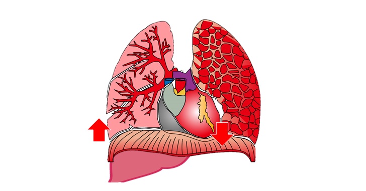 肝臓と心臓と横隔膜の位置