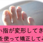 足の小指が変形してきた場合の対処法のブログトップ画像