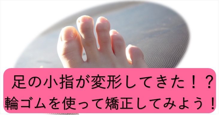 足の小指が変形してきた場合の対処法のブログトップ画像