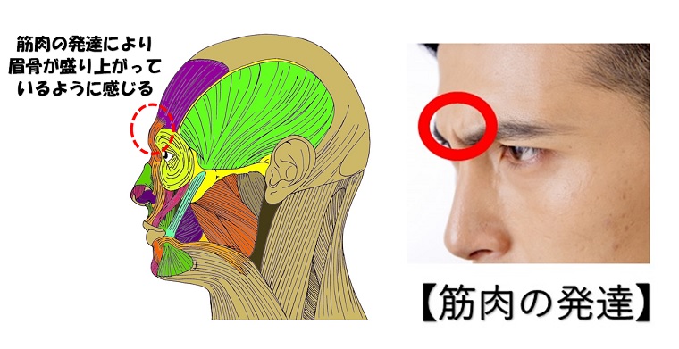 眉骨が出てる顔を自分で治すのは難しいですか お悩み相談 小顔矯正 整体を東京でお探しならrevision