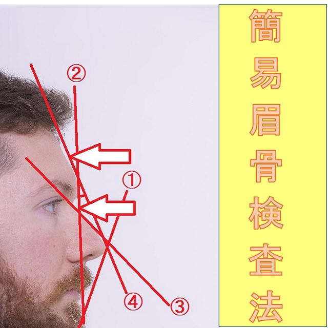 眉骨が出てる顔を自分で治すのは難しいですか お悩み相談 小顔矯正 整体を東京でお探しならrevision