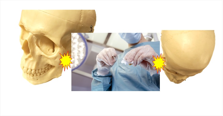 頬骨を低くする方法ってどうやるの 頬っぺたこ焼きの君へ 小顔矯正 整体を東京でお探しならrevision