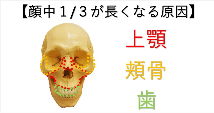 顔が長い悩みは原因が骨かたるみかによって対処法が変わる 小顔矯正 整体を東京でお探しならrevision