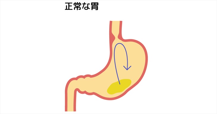 正常な胃の動きのイメージ