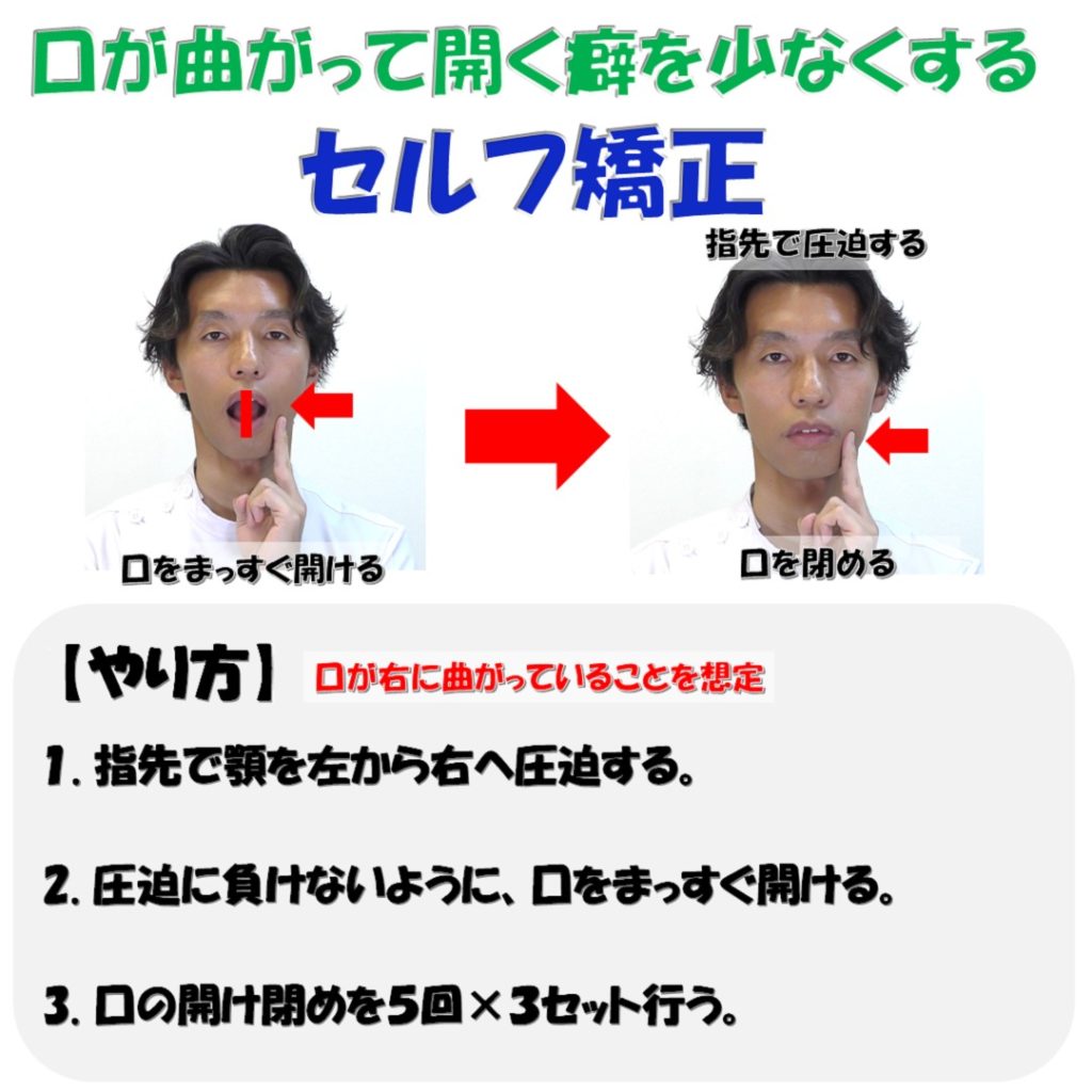 エラ張りは骨格と筋肉どっちが原因 簡単に出来るエラ張りの原因分析方法 小顔矯正 整体を東京でお探しならrevision