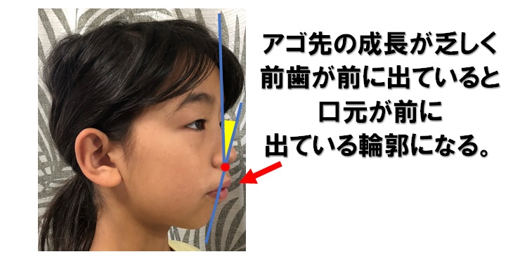 横顔が長い２パターンの矯正法 鼻から耳か エラが長いか 小顔矯正 整体を東京でお探しならrevision
