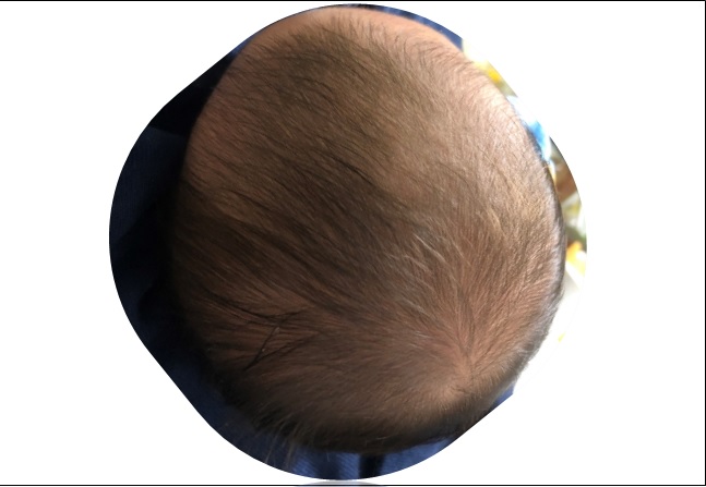 赤ちゃんの頭