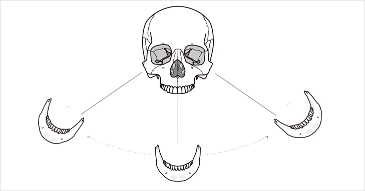 下顎平衝機能のイメージ
