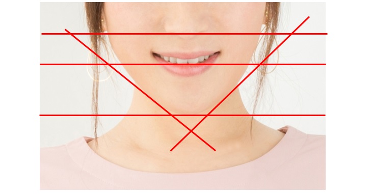 線付き顎の曲がりのイメージ