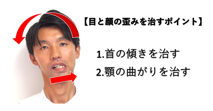 顎の左右非対称の原因はズレた顎での噛み癖と姿勢です 小顔矯正 整体を東京でお探しならrevision