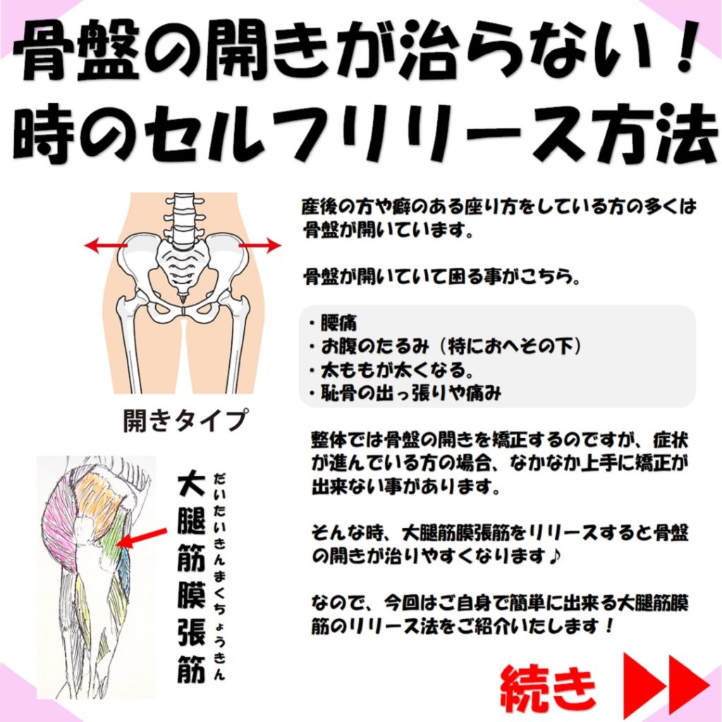 骨盤の開きと大腿筋膜張筋の関係