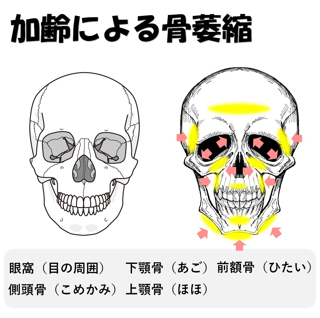 眉骨が出てる顔を自分で治すのは難しいですか お悩み相談 小顔矯正 整体を東京でお探しならrevision